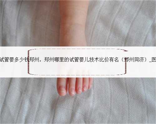 宫外孕试管婴多少钱郑州，郑州哪里的试管婴儿技术比价有名（郑州同济）_医