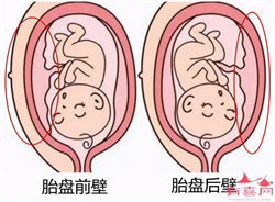 郑州借卵试管可以吗,郑州一附院试管婴儿怎么样？可以做试管成功吗？