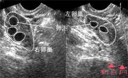 郑州高龄捐卵自孕,郑州陇海医院生殖科能做捐卵试管婴儿吗？